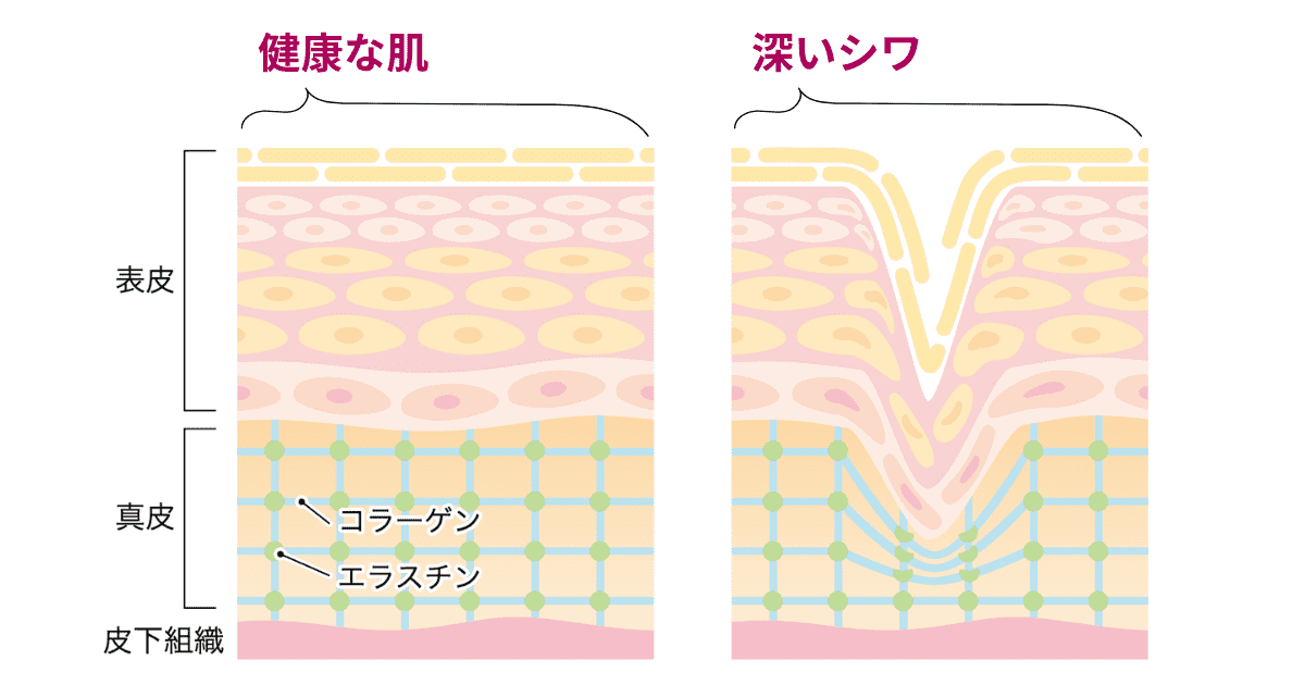 肌の表皮、真皮、皮下組織という三層構造